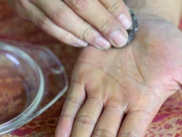 Tuz ile birlikte kullanlrsa siilleri giderir