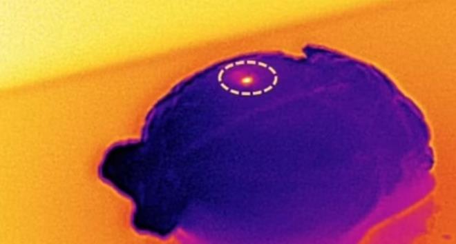 Aratrmaclar, gelitirdikleri beyin implantnn, beyindeki kt huylu tmrleri yok eden nanoparacklar etkinletirmek iin kzltesi k kullandn aklad. 15 gn sren gnde 15 dakikalk bir tedavi ile ou hastann kurtarlabilecei belirtildi.