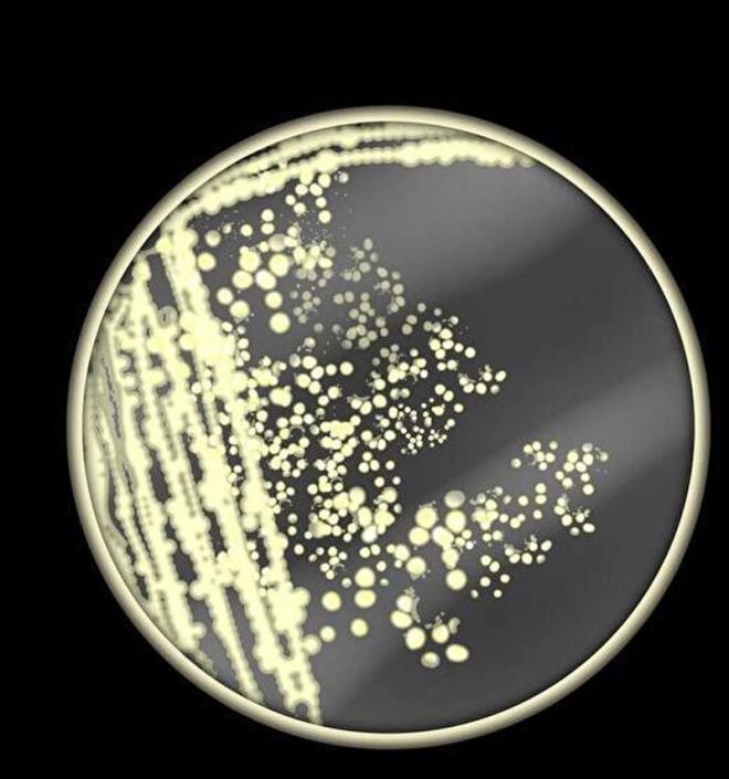 stelik bu enfeksiyonlar corafya ile snrl deil; Birleik Krallk da dahil olmak zere dnyann drt bir yanndaki insanlar giderek gten dren mantar hastalklarna maruz kalyor. Tipik olarak mantarlar, solunum yollarn istila ederek ve beyin de dahil olmak zere sinir sistemine saldrarak ldrr. Baklk sistemleri zayflam kiiler, kanser iin kemoterapi grenler veya HIV/AIDS tedavisi grenler istilac mantar enfeksiyonlar asndan en byk risk altndadr. Raporun yazarlarndan biri olan Haileyesus Getahun, The Telegraph ile yapt zel rportajda, 'Mantar hastalklar, zellikle istilac olanlar giderek daha yaygn hale geliyor ve bunlar zellikle savunmasz, bakl basklanm hastalar etkiliyor' dedi.