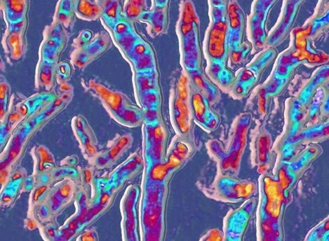Candida albicans ise salkl insan mikrobiyomunun bir paras olabilir, ancak oalrsa veya dier dokular istila ederse enfeksiyonlara da neden olabilir. Yzde 20-50 arasnda deien yksek mortalite ile hayat tehdit eden bir hastalk olan invaziv (dokular bozan) kandidiyazis retebilir. Listedeki dier patojenler arasnda mucorales, histoplazma spp, cryptococcus gattii ve fusarium spp var.