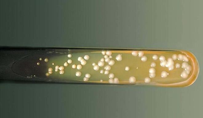 DS, en son 2018'de yaynlad listede 'X Hastal' da dahil olmak zere ncelikli patojenler listesini aklamt. imdi ise en tehlikeli 19 mantar trnn yer ald liste dnyaya duyuruldu. DS'nn AMR (antimikrobiyal diren) sorumlusu Dr. Hanan Balkhy "Bakteriyel antimikrobiyal diren pandemisinin glgelerinden ortaya kan mantar enfeksiyonlar byyor ve tedavilere her zamankinden daha direnli hale geliyor, bu da dnya apnda bir halk sal sorunu haline geliyor" dedi. Mantar Enfeksiyonlar iin Kresel Eylem Fonu, her yl 300 milyondan fazla insann ciddi bir mantar enfeksiyonuna yakalandn ve ylda 1 milyon 600 bin kiinin en yaygn enfeksiyonlardan ldn tahmin ediyor. 25 milyon insann daha lme veya grme yetilerini kaybetme riski altnda olduunu sylyor.