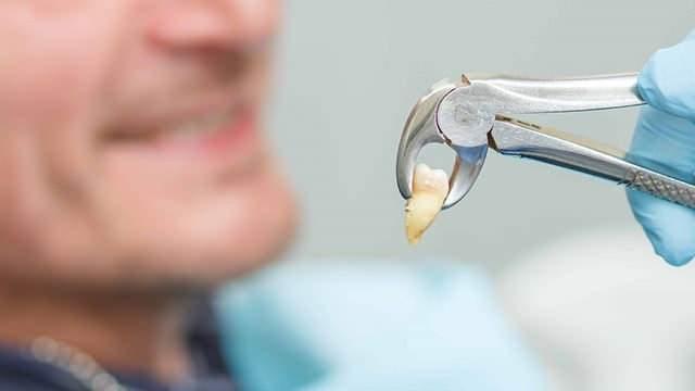 Di kk, ene kemiini uyararak onu gl tutmakla grevlidir. Di kk ene ile etkileimini braktnda ise di ekilmeleri balar. Eks&#8203;ik dilerin meydana gelmesi ile en yaygn grlen az hastalklar hakknda bilgi edinmek iin bu haberi okumaya devam edin.