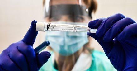 Salk Bakan Fahrettin Koca, dn gerekletirilen Kabine toplantsnda virs hakknda aklamalara deindi. Son gnlerde en yaygn hastalk olarak bilinen nfluenza gribi hakknda, Corona virs ile Influenzann birbirine kartn syledi. Peki bu kadar birbirine kartrlan nfluenza gribi nedir? nfluenza virs neye sebep olur?