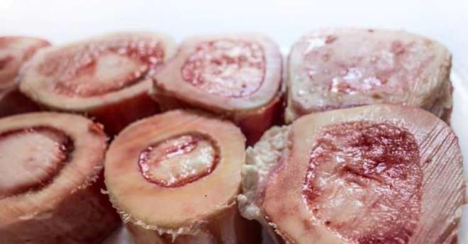 KEMK L DYABET N BR NUMARALI LA    nsln ve diyabet riskini azaltan adiponektin, salkl kan ekeri dzeyleri ve inslin duyarll iin son derece nemlidir. Kemik ilii ise bu durumda diyabet hastalar iin bir numaral ilatr.