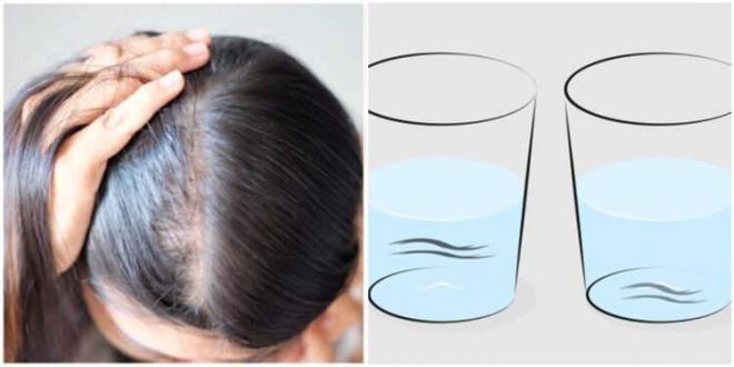 Krlgan yapdaki salar nasl onarrsnz?  <br>  ? eitli yalar salarn nemini geri kazanmasna ve daha salkl olmasna yardmc olur. Hint ya, hindistan cevizi ya ve aloe vera gibi yalar salarnz iin faydaldr.  <br>  ? PH dengesini ayarlamak iin sanza elma sirkesi de srebilirsiniz.