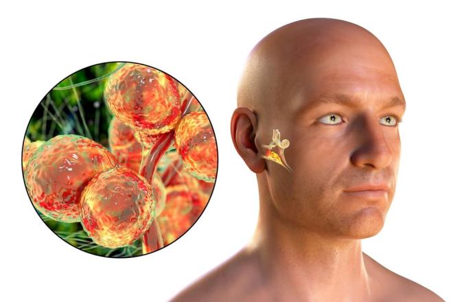 ABD Hastalk Kontrol ve nleme Merkezleri (CDC), C. auris'in "ciddi bir kresel salk tehdidi oluturan, gelimekte olan bir mantar" olduu konusunda uyard. Olduka bulac olan ve ok sayda antifungal ilaca direnli olan enfeksiyon, hlihazrda kronik salk problemleri olan kiilerde ciddi hastala neden olabilir.