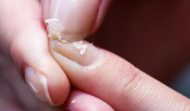 Trnaklarnz gszlemi ve ekil bozukluklar grlmeye baladysa...