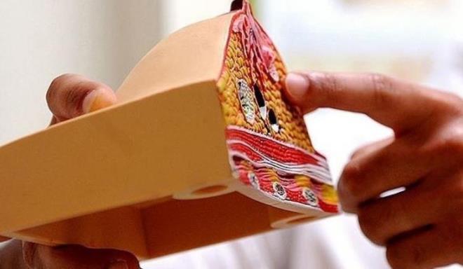 Beslenmenize srekli dikkat etmenize ramen midenizde rahatszlklar meydana geliyorsa...