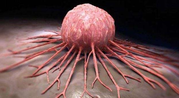 Dnya Salk rgt kanser hcrelerinin ilk belirtilerini vermeye balad srada vcutta meydana gelen durumlar u ekilde sralad: