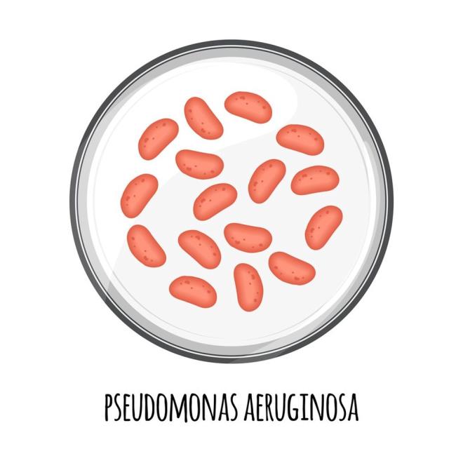 Kanda, akcierde veya yaralarda enfeksiyonlara neden olabilen Pseudomonas aeruginosa, antibiyotik direnci olarak bilinen antibiyotiklere kar savunma mekanizmalar gelitirdii iin hastaln tedavisi giderek zorlayor. CDC'ye gre bakteri genellikle hastanelerdeki veya dier salk hizmeti ortamlarndaki insanlara kirli sulardan bulayor.