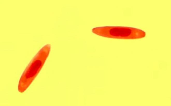 Kordiseps cinsi her bir mantar trnn farkl bir bcek, trtl ve am kese bcei pupasna ait parazit mantarlar olduunu belirten Erol, "Bu mantar asl nemli klan ey binlerce yldan beri geleneksel in tbbnda ifa kayna olarak kullanlmas." dedi.