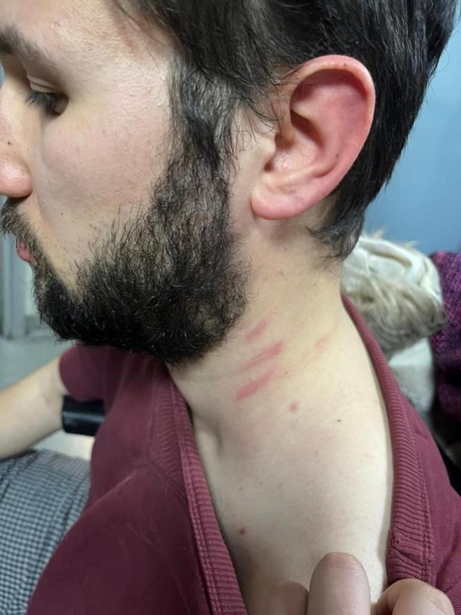 Kadky'de kiracya "evden k" daya - 8  "TOPLUMSAL NFAL UYANDIRACAK SULAR"    Gker Kumdakc'nn avukat Halil brahim Sert ise, "u an karakola ikayette bulunduk. Mvekkilimin anlatmasndan konut dokunulmazlnn ihlal edildii, birden fazla kii tarafndan darbedildii ve gaspa urad belli. Burada su tipleri ak. Toplumsal infial uyandracak sular. Kiralarn ar artmas nedeniyle kimilerinin itah kabarrken, kimileri madur oluyor. Bu ortamda tek sz syleyecek eyin hukuk olmas gerek." ifadelerini kulland.