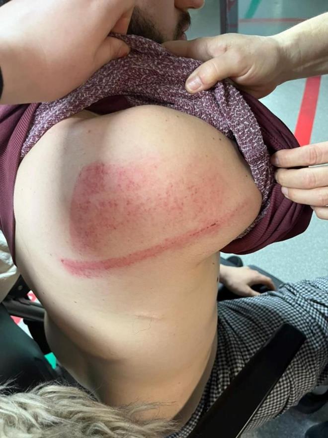 Kadky'de kiracya "evden k" daya - 7  "LK SOKAKTA SALDIRIYA URADIM"    Kumdak aklamalarna yle devam etti:    "lk olarak sokakta saldrya uradm, boazm sktlar. kinci saldr apartman ierisinde oldu. Bu kez kardeleri geldi. Dairemin elektriini kesmiler, ben de aa indim. Kendileri bana 'Biz ev sahibiyiz' dediler, kendilerine davann srdn syledim. Baktm olacak gibi deil 112'yi aramaya altm, o an telefonu elimden ekip saldrmaya baladlar. Ben sadece barabildim, komum kapya knca katlar. u an iyi deiliz, eim de evdeydi. Artk eve korkarak giriyoruz. Bugn de evde kalmayacaz. Byle bir olayn Kadky'de olmas bana ok garip geliyor. Gerei neyse yaplmasn talep ediyorum."