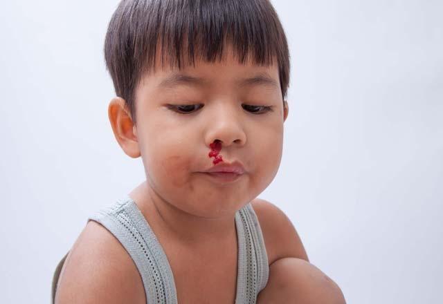 - Di eti kanamalar, uzun sre gemeyen yaralar ve burun kanamalarnda art, en nemli belirtilerindendir.