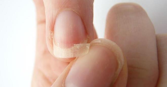 Ayak trnaklarnn ise yuvarlak deil kt bir ekilde kesilmesinin trnak batmas gibi problemleri nleyeceini belirten Dr. zlem Apti Sengkioun, ayrca trnaklara bask yapan dar ve sert ayakkablar giyilmemesini, manikr ve pedikr yaplyorsa trnak etlerinin derin temizlenmesinden kanlmasn ve kullanlan aletlerin steril ayn zamanda kiiye zg olmas gerektiini vurguluyor.