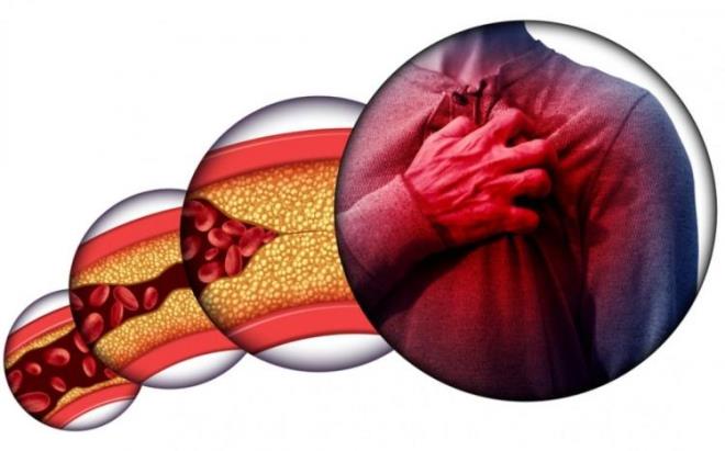 Kolesterol  kanda bulunan, mumsu bir yapya sahiptir. nsan vcudunun salkl hcreleri oluturabilmesi iin hcre zarlarnn yan sra baz hormonlar ile D vitamininin oluturulmasnda kullanmak zere belirli bir miktar kolesterole ihtiyac vardr.