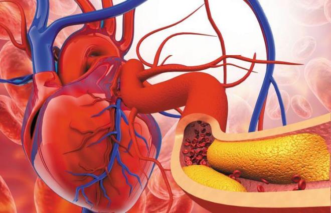Getiimiz on ylda kalp sorunu ve bask, kolesterol, ateroskleroz gibi problemleri yaayanlarn says artt. Bunlarn nedeni salksz beslenme ve hareketsizlik.  Ani kalp krizi, fel gibi yaam tehdit eden sorunlara yol aan yksek kolesterol seviyelerini kontrol altnda tutmak ise yaamnz kurtarabilir. ite tkanm damarlar aan elma yntemi...