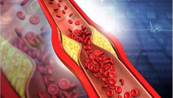 Kolesterol ykselten nedenler arasnda beslenme tarz, ilerleyen ya, imanlk, geirilmi baz hastalklar, kullanlan ilalar, sigara ve genetik yatknlk bulunur.