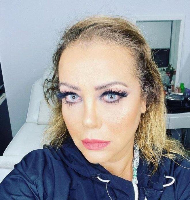 Tanyeli, ameliyattan sonra istedii grntye kavutu.