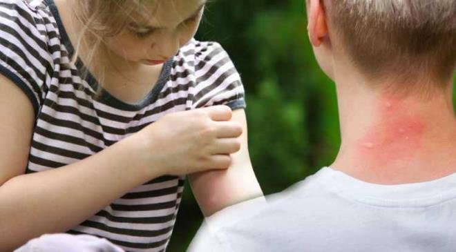 Yaz mevsiminde havalarn snmasyla ortaya kan sivrisinekler vcutta ak bulduklar blgeleri srp kzarkla ve kantya neden oluyor. Sivrisinek srklar sonras oluan kzarklardan kurtulmak ve kanty nlemek iin etkili doal yntemlerin neler olduu internette aratrlyor. Peki, sivrisinek sokmasna ne iyi gelir, sivrisinek kantsn  yok eden en etkili yntemler neler? te detaylar: