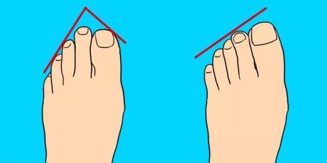 Ayak tipiniz Msrl m, Yunan m, Alman m, Romal m yoksa Keltli mi olduunuzu belirlemeye yardmc oluyor.