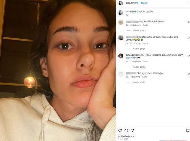 Geirdii operasyonlar ile adeta yz ifadesi deien gen oyuncu sosyal medya hesab zerinden yapt paylamda hakknda kan iddialara ithafen "Vallahi bezdim" aklamasn yapmt.