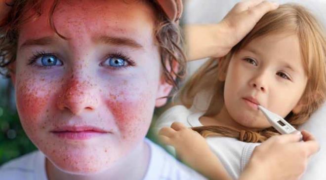 Yaz mevsimi ocuklar iin tatil, elence anlamna gelse de znde getirdii tehlikelere kar uyaran uzmanlar aklad. Yaz aylarnda ocuklarn daha fazla korunmas ve gnein verdii zararlardan korunmas art! Aksi halde fark edilmeden lme bile neden olabilecek sonular dourabilir. Peki yazn ocuklar bekleyen tehlikeler nelerdir bunlardan korunmann yollar nelerdir?