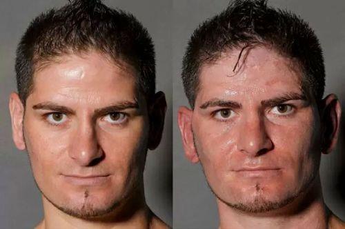 Boksrlerin ma ncesi ve ma sonras fotoraflar