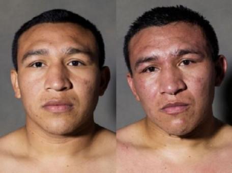 Boksrlerin ma ncesi ve ma sonras fotoraflar