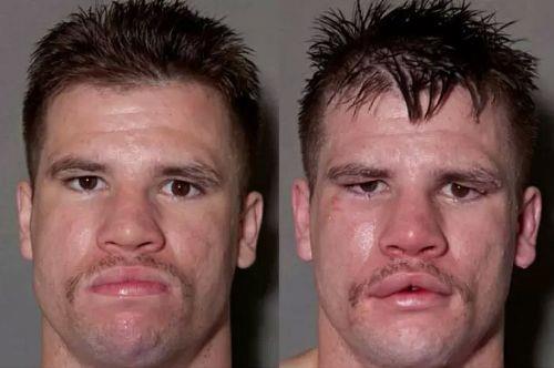 Boksrlerin ma ncesi ve ma sonras fotoraflar