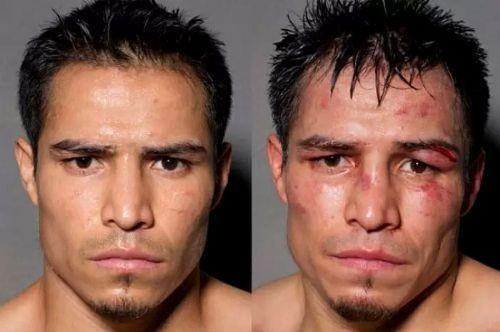 Boksrlerin ma ncesi ve ma sonras fotoraflar