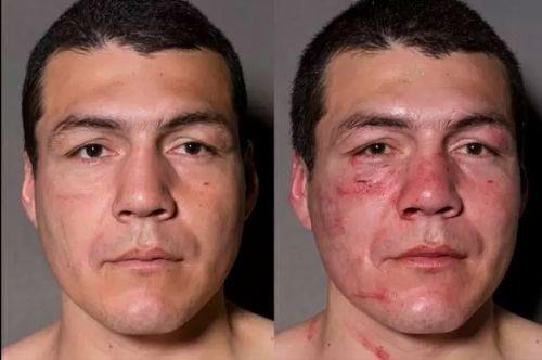 Boksrlerin ma ncesi ve ma sonras fotoraflar