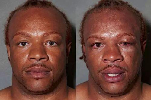 Boksrlerin ma ncesi ve ma sonras fotoraflar