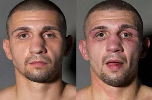 Boksrlerin ma ncesi ve ma sonras fotoraflar