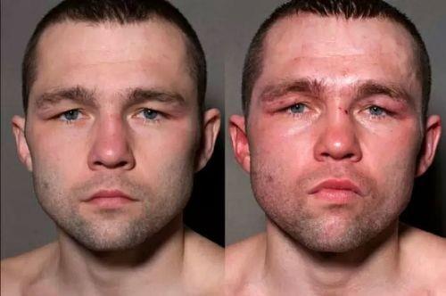 Boksrlerin ma ncesi ve ma sonras fotoraflar