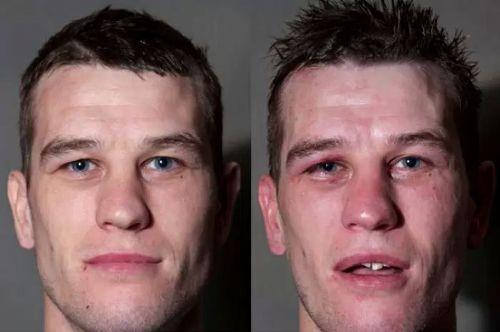 Boksrlerin ma ncesi ve ma sonras fotoraflar