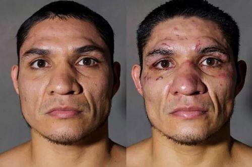 Boksrlerin ma ncesi ve ma sonras fotoraflar