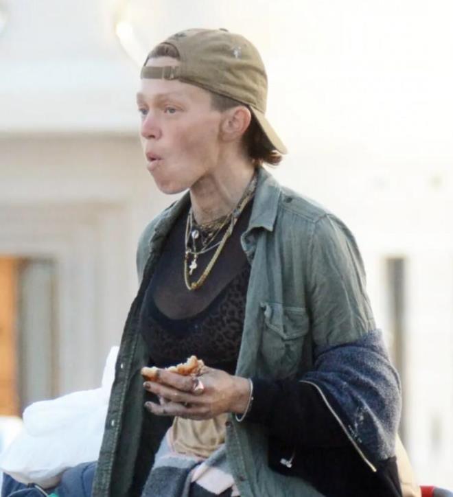 Bunun nedenini de u szlerle anlatt: "nk bir yl boyunca birisi bana neredeyse her gn elektrik verdi." Willison, kulland ve penesinden kurtulamad kt alkanlklarnn da bu duruma yol am olabileceini belirtti.