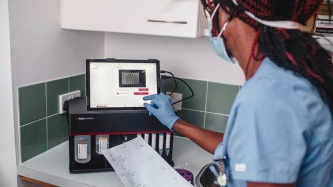 NE ZAMAN PYASAYA SRLECEK?    u anda, 7 ila 10 dakika iinde sonu veren teknoloji, tezgah st bir laboratuvar cihaznda alyor. Ancak Attomarker, gelecek yl cep telefonuna bal bir tehis kartuuna sahip bir el cihazn piyasaya sreceini belirtti.