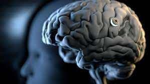 Servikal omurilik yaralanmas veya amiyotrofik lateral skleroz nedeniyle fel geirenlerin almaya katlabilecei belirtildi, ancak tamamlanmas yaklak alt yl srecek olan denemeye ka katlmcnn kaydedilecei aklanmad.