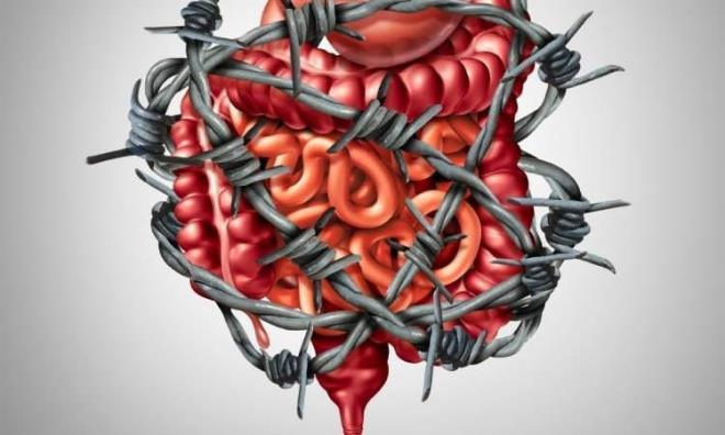 kinci beyin olarak bilinen barsaklar, ilevini kaybetmeye baladnda kabzlk sorunu ortaya kyor. Tketilen besinler ne kadar salkl olursa barsaktaki faydal bakterilerin says o kadar ok artyor. Salksz beslenmeyle birlikte zararl bakteri art yaanyor, bu durum gaz, ikinlik, kabzlk gibi pek ok sorunu beraberinde getiriyor. Uzmanlar, dmlenmi barsaklar annda zen, kabzl yok eden besinleri tek tek sralad.