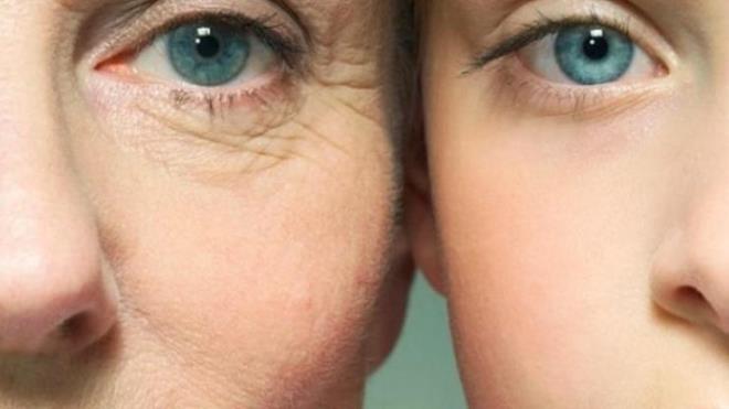 Son dnemde toplumda popler hale gelen estetik ilemler d grn tamamen deitirirken gzellik algsn da adeta yerle bir etti. Gzellemek iin bak altna yatan birok nl isim ise deiimiyle artyor.