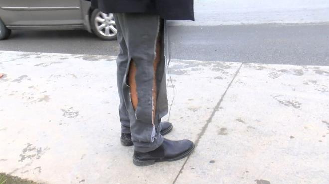 Kpekler uyuturucu ine vurularak ekipler tarafndan yakalanp olay yerinden gtrld.