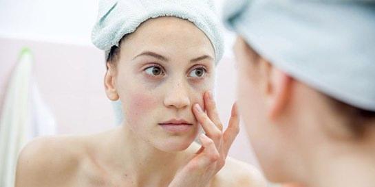 - Maya, yksek oranda protein, B6 vitaminlerini ierdii iin cildin yenilenmesini ve atk maddelerden arnmasn salyor.  <br>  - Hcrelerin yenilenerek cildin onarlmasna olduka katk salayan maya maskesi, hem kuru hem de yal cilt tiplerine uygulanabilir. Ayn zamanda cilde nem katar, nemlendirirken ya dengesini de korur. Cildi derinlemesine temizleyerek akne oluumunu engeller.