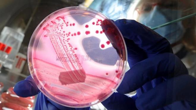 FARELERDE GEN TERAPS YALANMAYI TERSNE EVRD    Ocak aynda henz yaynlanmam bir almada, deneysel gen terapisi enjekte edilen fareler tedaviden sonra plasebo alan farelere gre yzde 109 daha uzun yaad.    "r aan" deneyde bilim insanlar, normalden daha hzl yalanmalarna neden olan gen mutasyonlarna sahip fareler zerinde alt.    Gen terapisi alan fareler 18,5 hafta daha yaad.