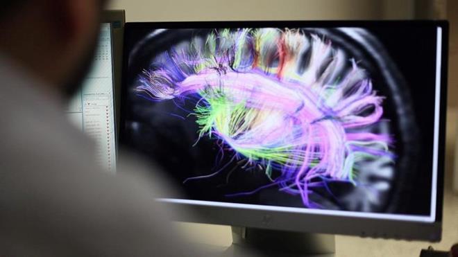 STRESN ZNCRLEME ETKS    artc olmayan bir ekilde her ey beyinde balyor. Spesifik olarak, duyguyla ilgili organn merkezindeki amigdala.    Bir tetikleyici ortaya ktnda bu blge adrenal bezlere sinyaller gndererek onlara kortizol ve adrenalin ad verilen hormonlar salglamalarn sylyor.    Bunlar vcudun tehlikede olduunu haber veren "sava ya da ka" hormonlar.