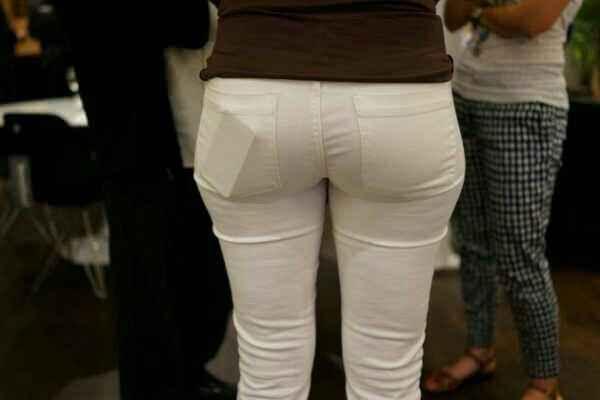 CZDAN SENDROMU KADINLARDA DA GRLYOR MU?    Kadnlarda erkeklere oranla daha sk grlr. Bir yana eilerek oturmak ve piriformis kasnn spazm sonucu benzer ikayetler olur. zellikle hamileliin son aylarnda vcuttaki arlk merkezinin ne kaymas sonucu piriformis kasnn yrme ya da oturma esnasnda zorlanmasna bal olarak benzer ikayetler oluur.