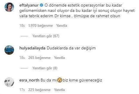 'Sultan' lakabyla Trk sinemasnda yer edinmi yeilam yldz kariyerinin ilk yllarndaki estetiksiz halleri ile sosyal medyada ok konuuldu. Trkan oray'n estetiksiz halini grenler doktorunu tebrik etti.
