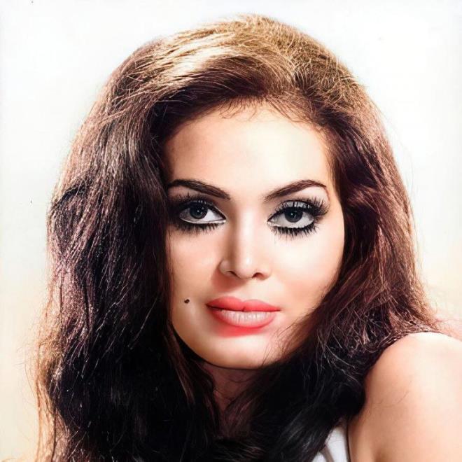 Oyunculuk kariyerinin bandayken dudaklarn ve burnunu yaptran Trkan oray'n estetikleri ilk bakta kimse tarafndan fark edilemiyor.