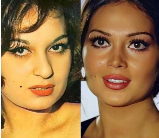 te Trkan oray'n gren herkesi akna eviren estetiksiz halleri...